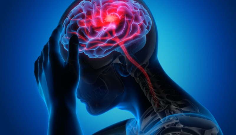 Factori care pot creşte riscul de accident vascular cerebral 