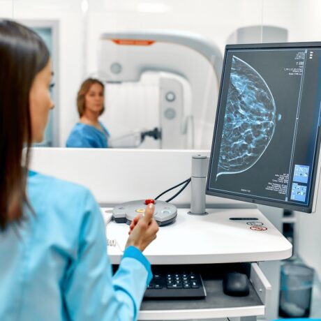Medic și pacientă care efectuează o mamografie pentru cancerul de sân
