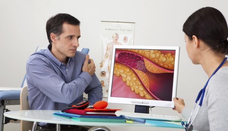 Bărbat la medic căruia i se arată ce efecte are un colesterol mărit asupra vaselor de sânge și cum se depune pe artere