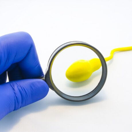 Spermatozoid analizat sub lupă de un specialist care poartă mănuși chirurgicale