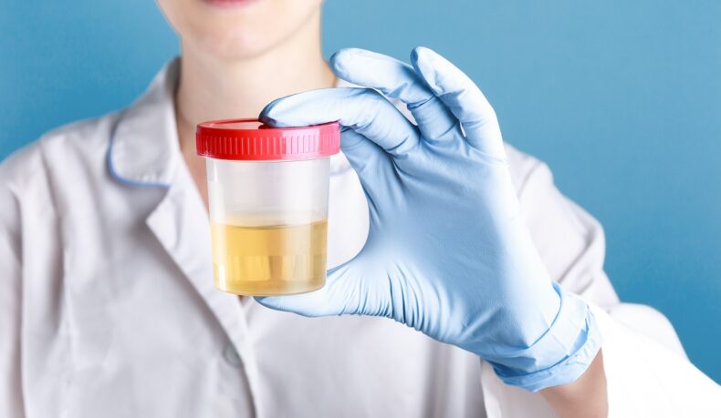 Medic care ține în mână o probă de urină, sugestiv pentru diferența dintre sumar de urină și urocultură
