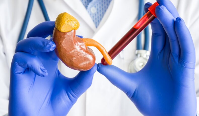 Medic care ține în mână o machetă de rinichi și o eprubetă cu sânge, sugestiv pentru creatinina serică, analiza care evaluează sănătatea rinichilor