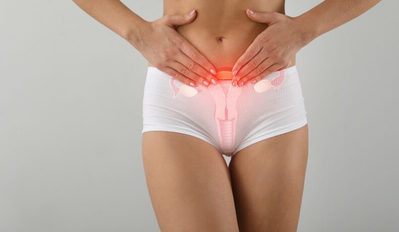 Femeie cu imaginea uterului pe abdomen și cu dureri abdominale, un simptom cauzat de uterul retrovers