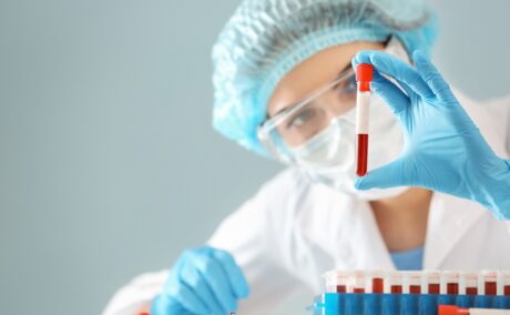 Medic în laborator cu eprubetă de sânge în mână. Homocisteina poate fi evaluată printr-o analiză de sânge