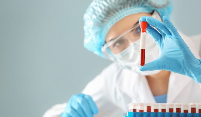 Medic în laborator cu eprubetă de sânge în mână. Homocisteina poate fi evaluată printr-o analiză de sânge