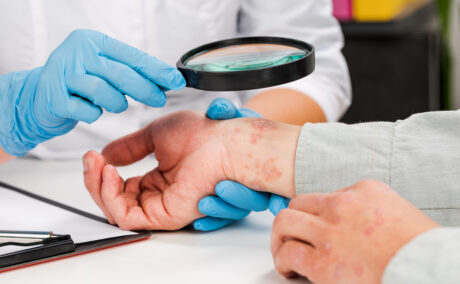 Un dermatolog tânăr care poartă mănuși examinează cu lupa pielea unui pacient bolnav