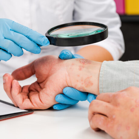 Un dermatolog tânăr care poartă mănuși examinează cu lupa pielea unui pacient bolnav