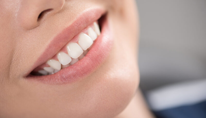 Cauze ale eroziunii smalțului dentar. Cum îți poți proteja dinții