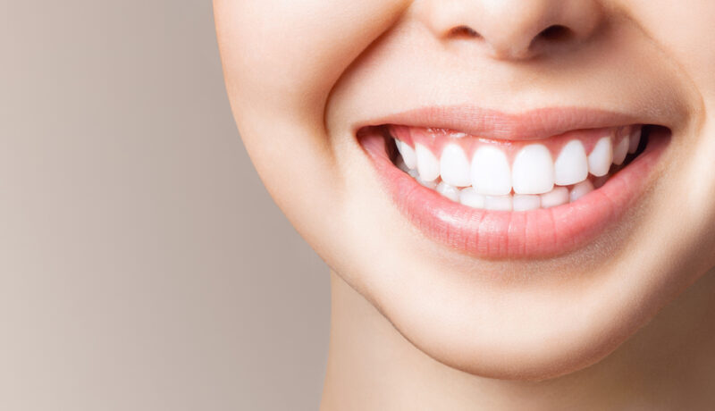 Cum îți poți albi dinții. Metode naturale de îngrijire