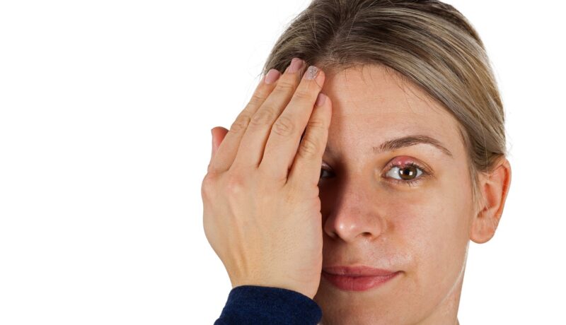 Urcior la ochi (orjelet): cauze, simptome și opțiuni de tratament
