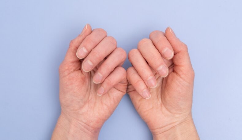 Principalele cauze ale învinețirii unghiilor. Ce boli pot indica