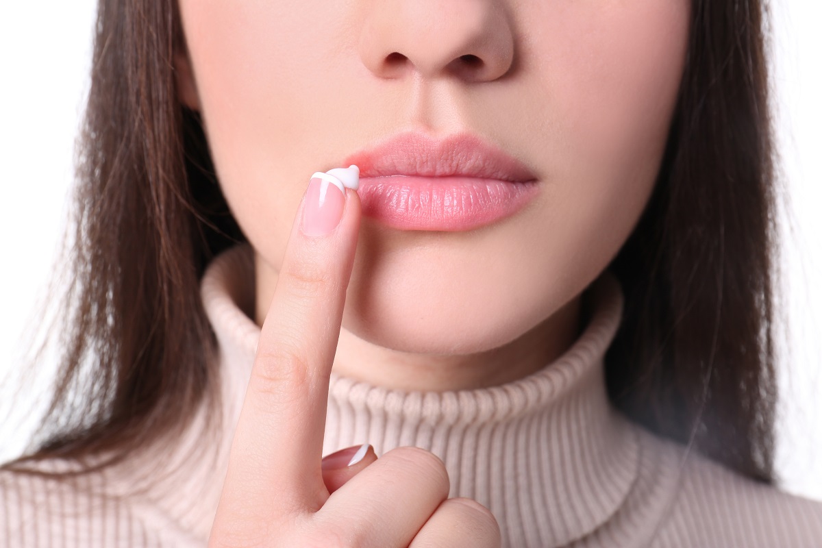 Femeie care dă cu cremă pe un herpes la gură, pe buză, cremele antivirale fiind un Tratament rapid pentru herpesul la gură