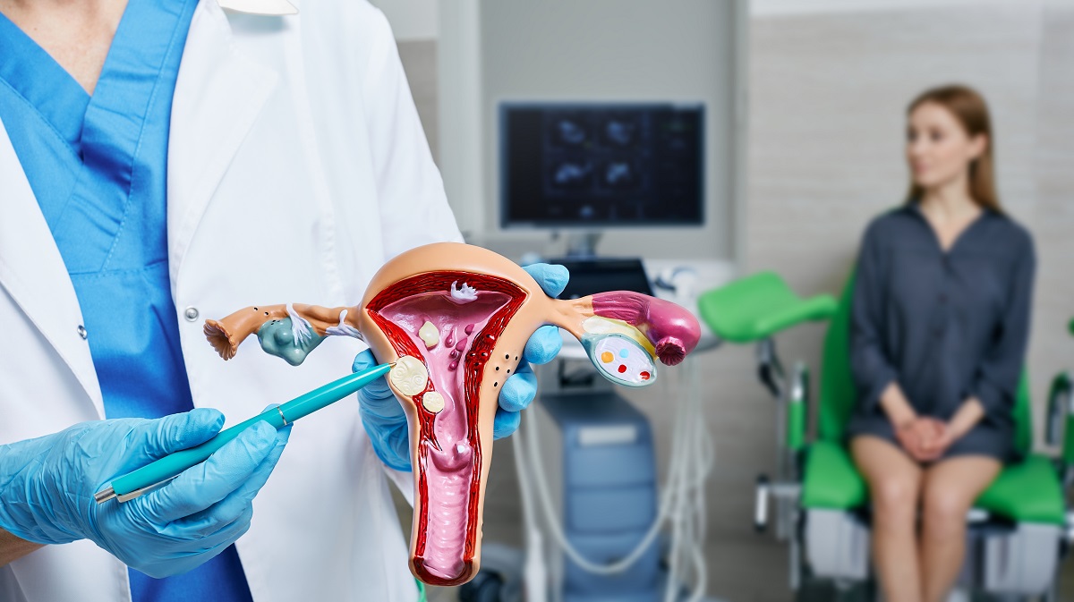 Doctor care prezintă fibromul uterin pe o machetă și pacientă în fundal, în cabinetul ginecologic