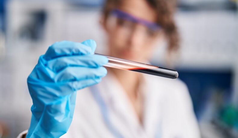 Femeie medic de laborator care ține în mână o eprubetă cu sânge, sugestiv pentru biopsia lichidă