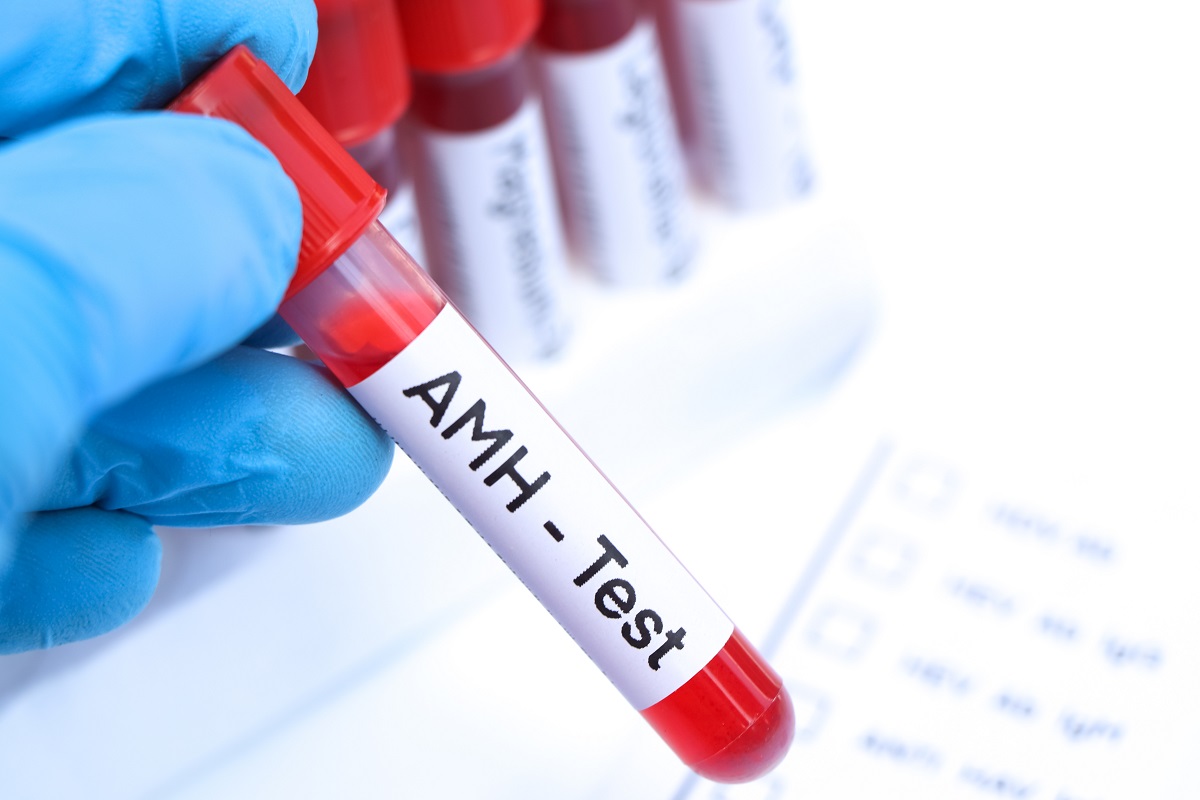 Detaliu cu eprubetă cu sânge și etichetă cu AMH - test