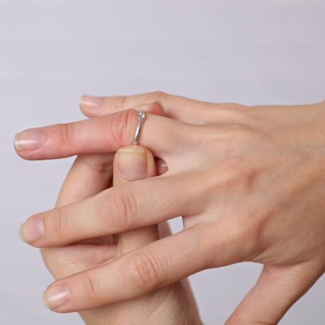 Detaliu cu mâini de femeie cu inel blocat pe deget, sugestiv pentru mâini umflate