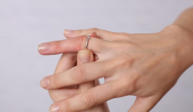 Detaliu cu mâini de femeie cu inel blocat pe deget, sugestiv pentru mâini umflate