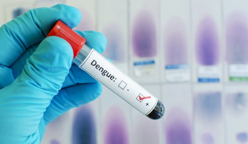 detaliu mână cu eprobetă de sânge, test pozitiv pentru febra Dengue