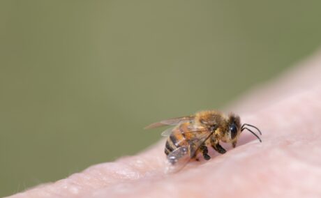 Remedii naturale pentru înțepătura de albină. De ce pot ameliora simptomele