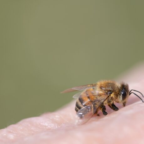 Remedii naturale pentru înțepătura de albină. De ce pot ameliora simptomele