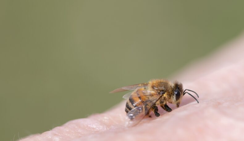 O albină care stă pe pielea unei persoane