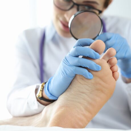 Un medic care examinează cu lupa unghiile de la picioare ale unui pacient