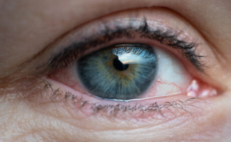 Nutrienți care pot combate sindromul de ochi uscat. Cum pot ameliora simptomele