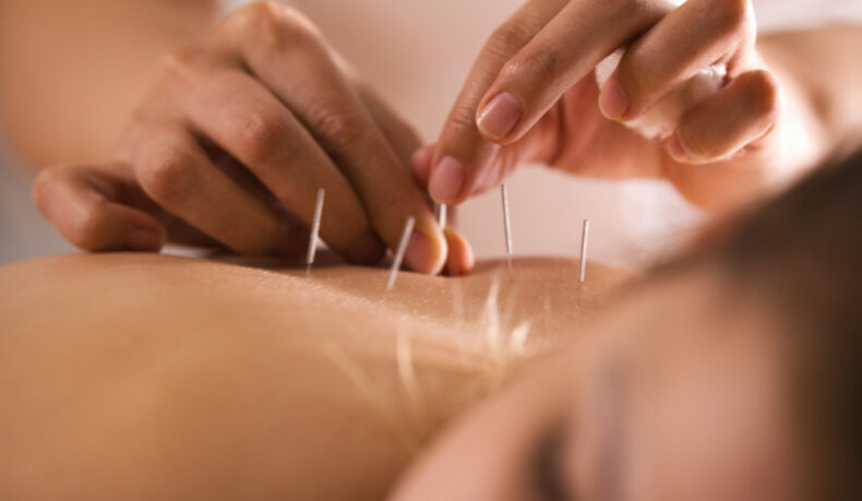 Acupunctura în infertilitate, o terapie cu mai multe beneficii