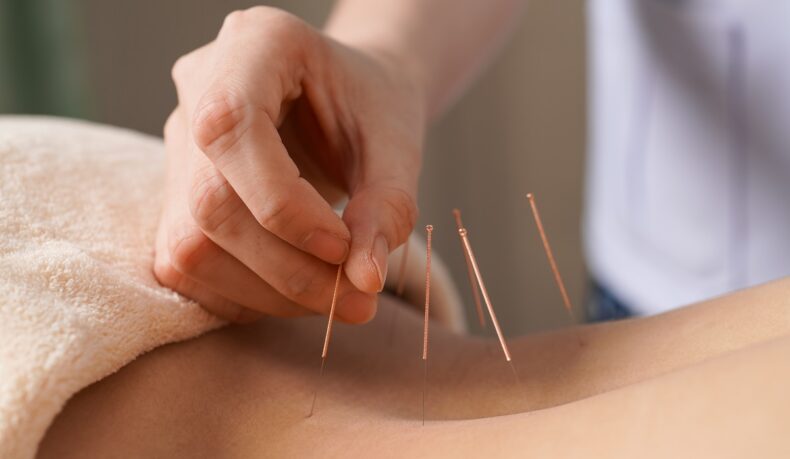 Acupunctura este dureroasă? Cum se simte și cum funcționează acest tratament