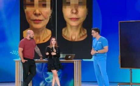 Top 6 cele mai cerute intervenții estetice la clinicile de înfrumusețare