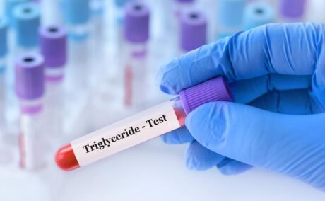 Trigliceride mărite: ce valori normale au trigliceridele, de ce cresc și care sunt riscurile pentru sănătate