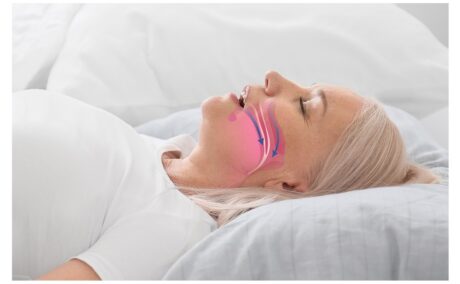 Tot ce trebuie să știi despre sindromul de apnee în somn: ce este, cum se manifestă și cum se tratează