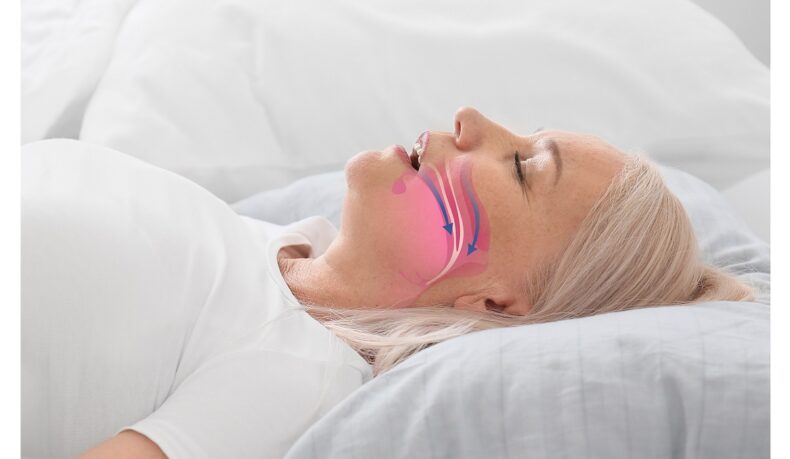 Tot ce trebuie să știi despre sindromul de apnee în somn: ce este, cum se manifestă și cum se tratează