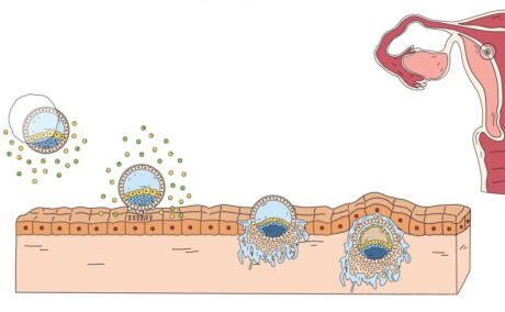 De ce nu e indicat contactul sexual după embriotransfer