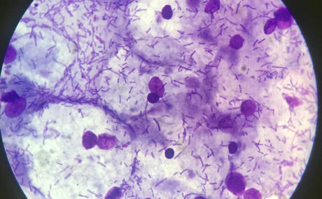 Flora vaginală și fertilitatea. Cum să „hrănești” bacteriile bune care îți cresc șansele de a rămâne gravidă