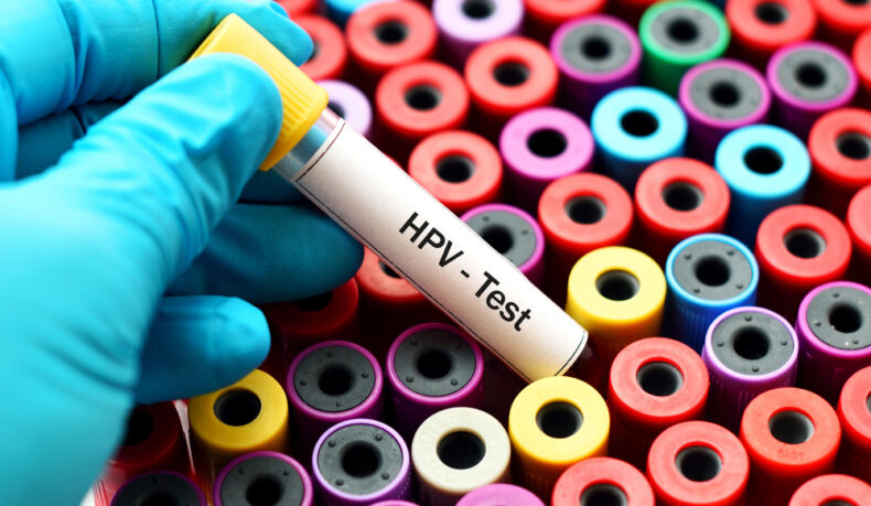 Ce înseamnă un rezultat HPV modificat