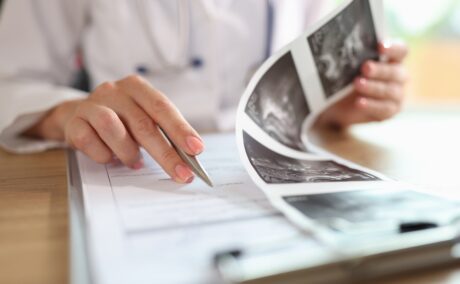 Chist ovarian sau endometriom? Care este diferența și cum pot afecta fertilitatea
