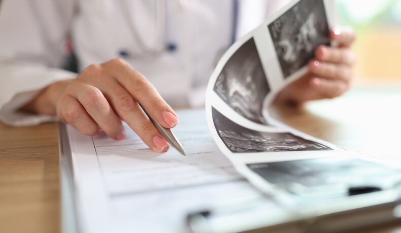 Chist ovarian sau endometriom? Care este diferența și cum pot afecta fertilitatea